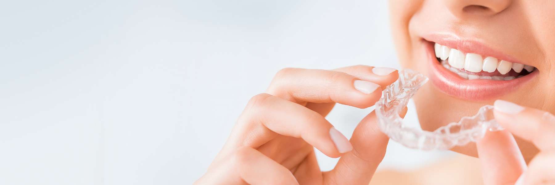 Clear Aligners | Dentist
