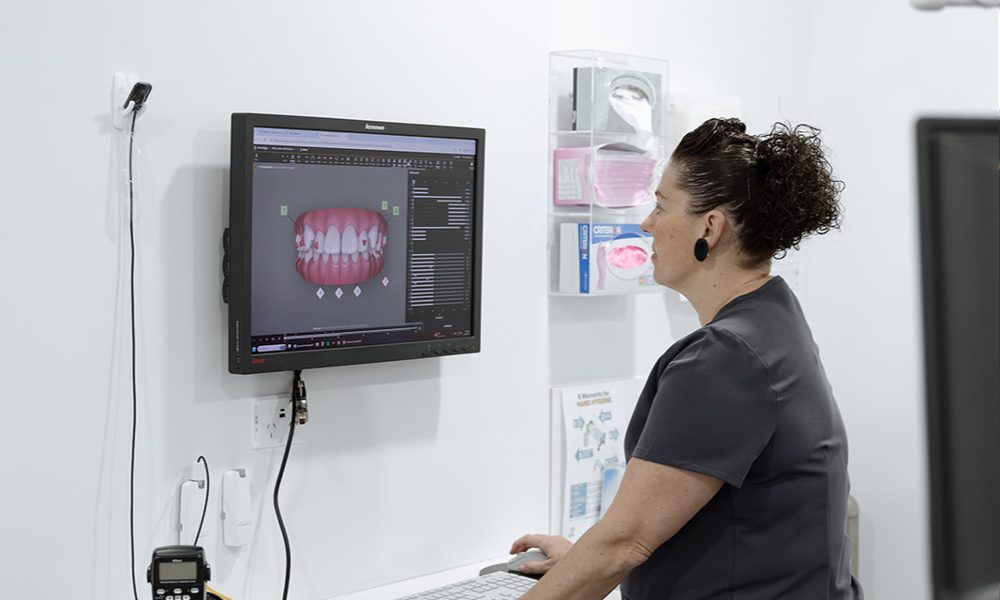 Digital dental scanning and treatment planning at Singleton Smiles