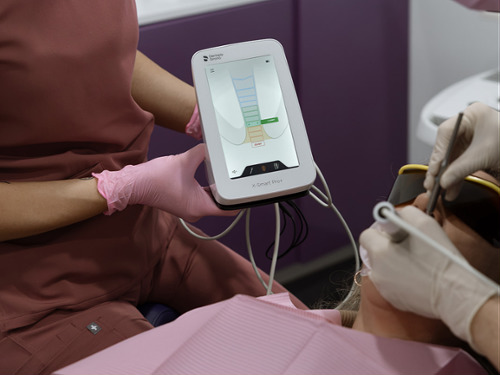 Dentist using Dentsply Sirona X-Smart Pro+ rotary endodontic motor during root canal treatment on patient