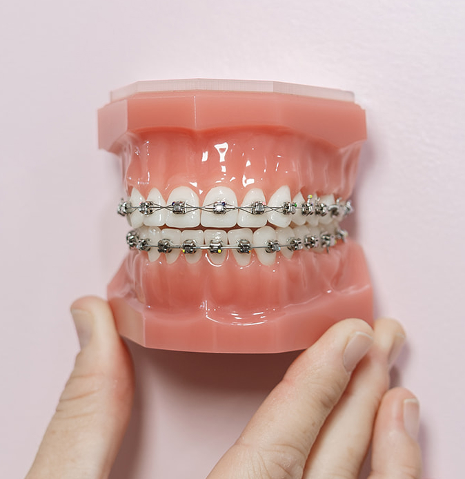 Dentist reviewing a dental scan at Singleton Smiles