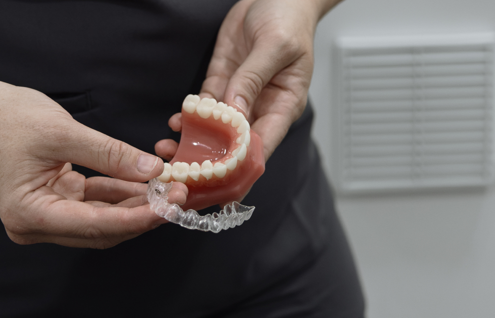 Clear aligners treatment at Singleton Smiles